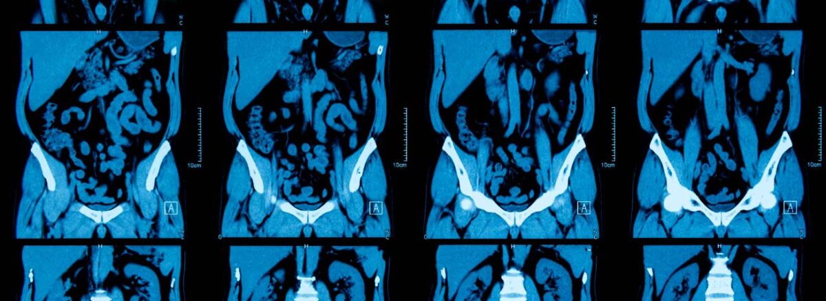 spx-clinica-spx-imagem-exame-de-tomografia-do-abdomen