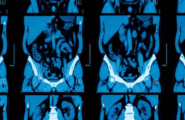 spx-clinica-spx-imagem-exame-de-tomografia-do-abdomen