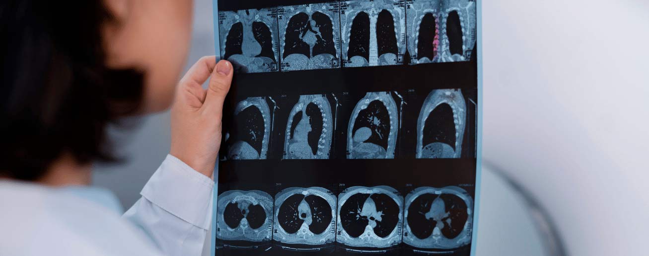 spx-clinica-spx-imagem-importancia-exame-de-tomografia-do-abdomen