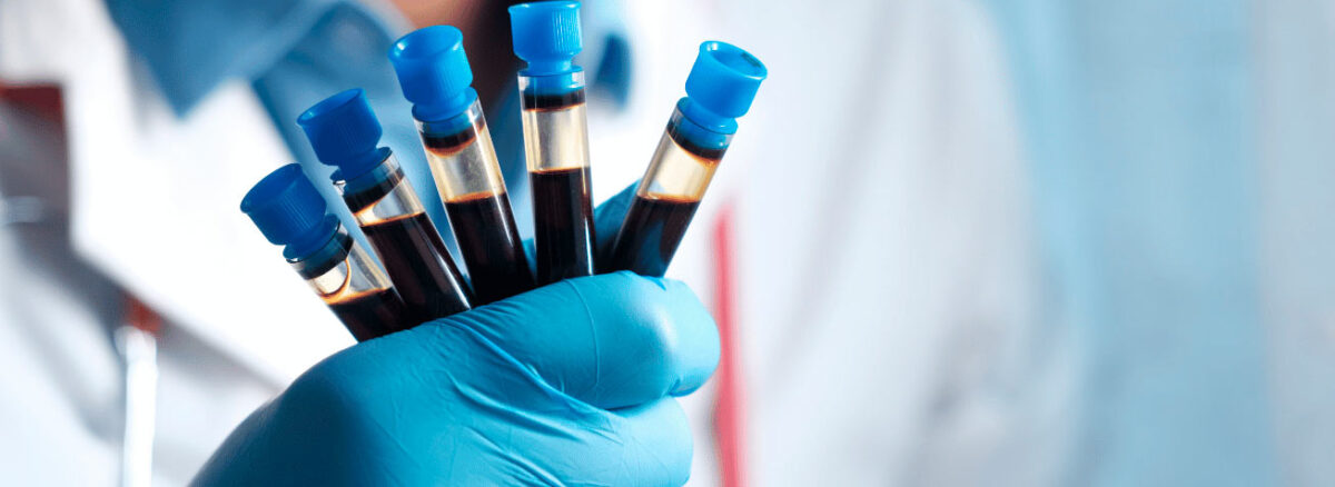 spx-clinica-spx-imagem-principais-exames-de-analises-clinicas