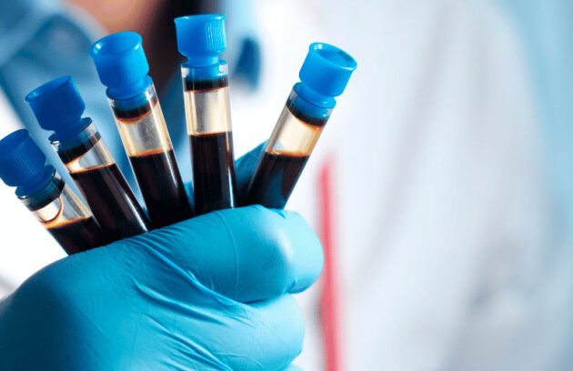 spx-clinica-spx-imagem-principais-exames-de-analises-clinicas