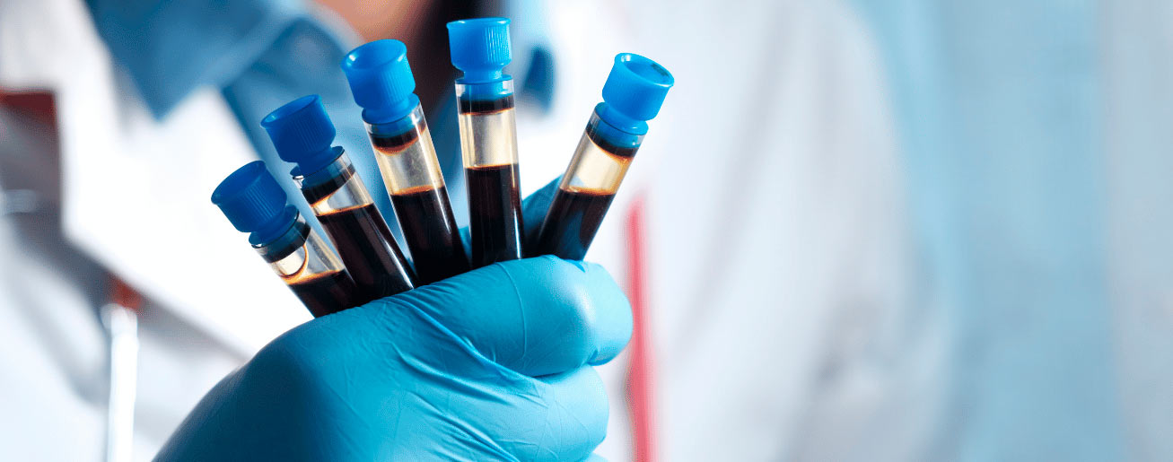 spx-clinica-spx-imagem-principais-exames-de-analises-clinicas