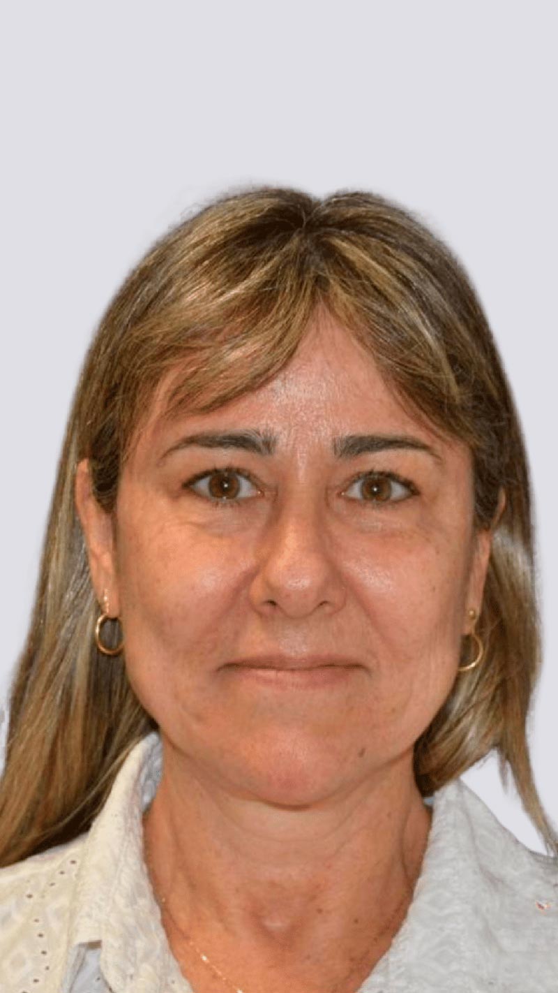 spx-imagem-spx-hpm-belo-horizonte-real-dra-monica-scarpelli-radiologista