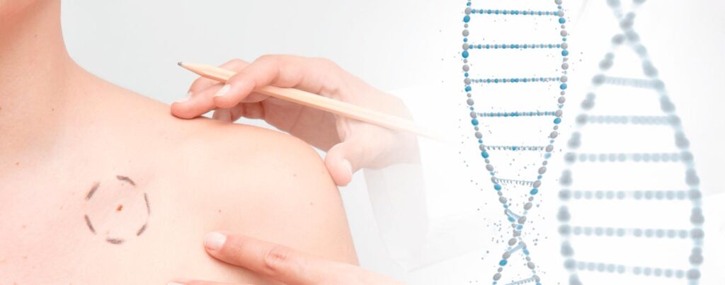 spx-clinica-spx-imagem-genes-podem-influenciar-tratamento-de-cancer-de-pele