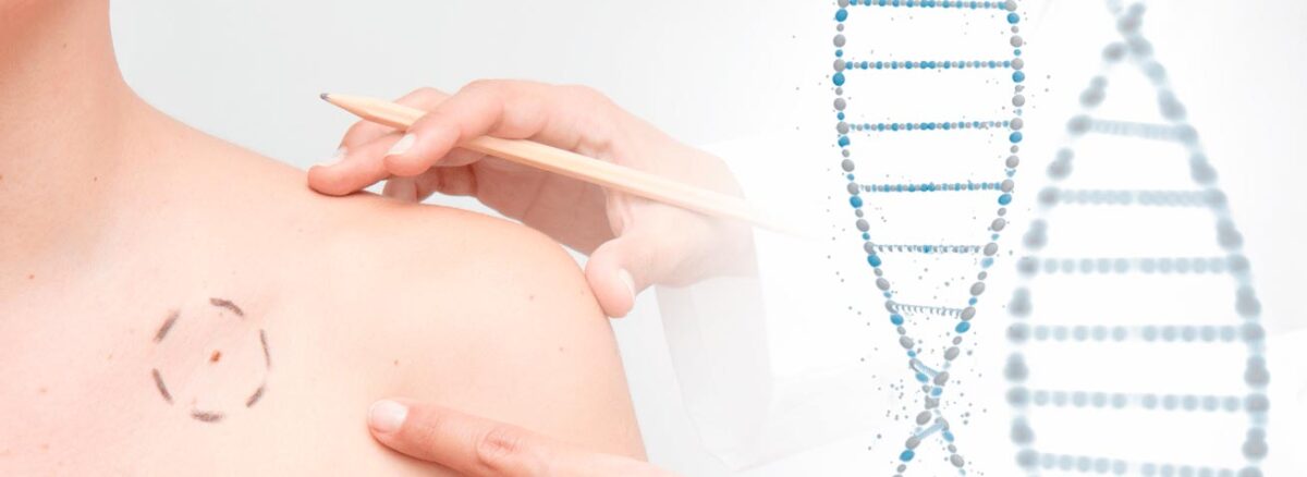 spx-clinica-spx-imagem-genes-podem-influenciar-tratamento-de-cancer-de-pele