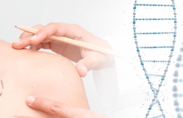 spx-clinica-spx-imagem-genes-podem-influenciar-tratamento-de-cancer-de-pele