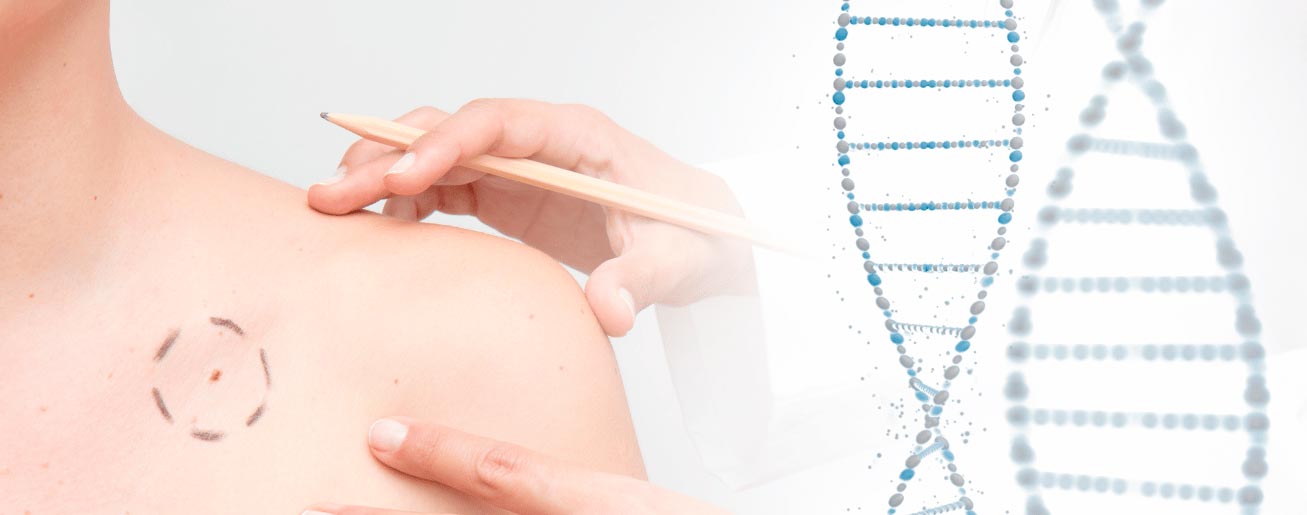 spx-clinica-spx-imagem-genes-podem-influenciar-tratamento-de-cancer-de-pele