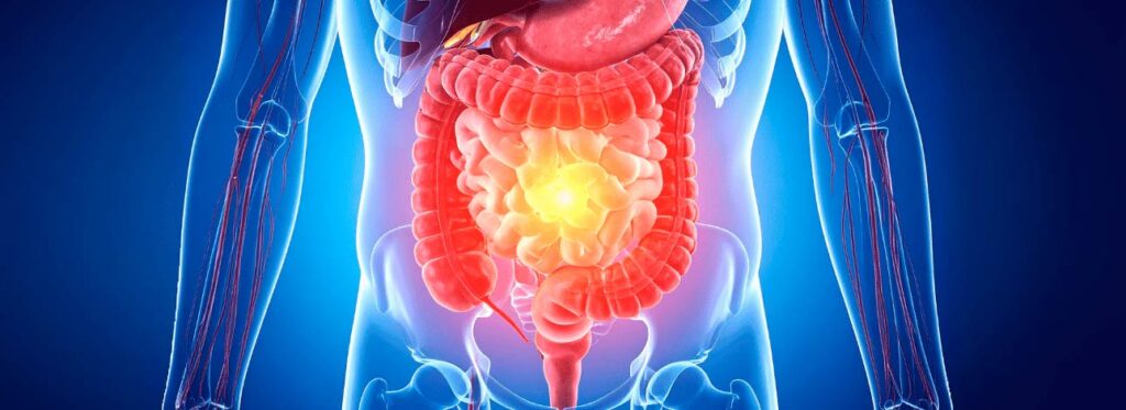 spx-clinica-spx-imagem-problemas-no-intestino-e-reto