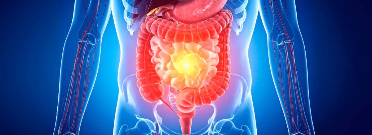 spx-clinica-spx-imagem-problemas-no-intestino-e-reto