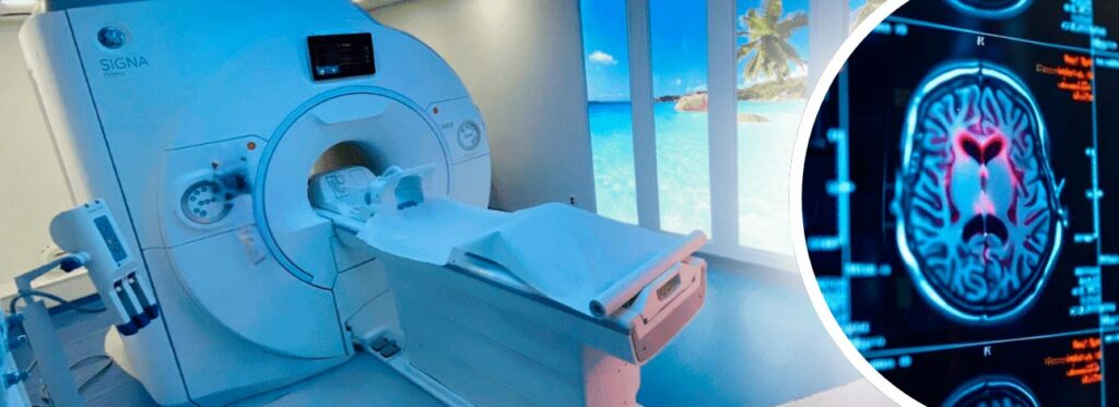 spx-clinica-spx-imagem-ressonancia-pode-prever-alzheimer