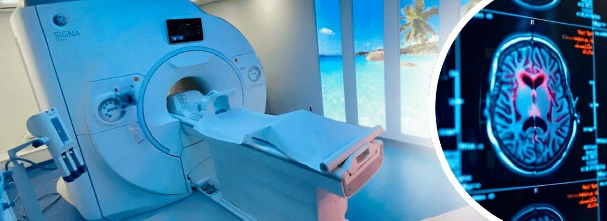 spx-clinica-spx-imagem-ressonancia-pode-prever-alzheimer
