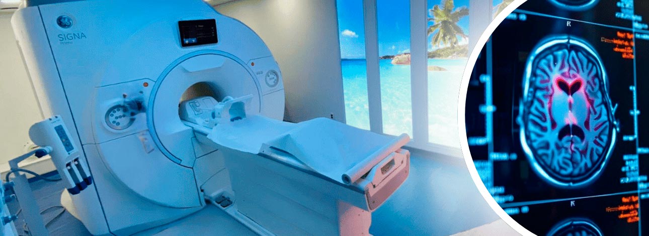 spx-clinica-spx-imagem-ressonancia-pode-prever-alzheimer