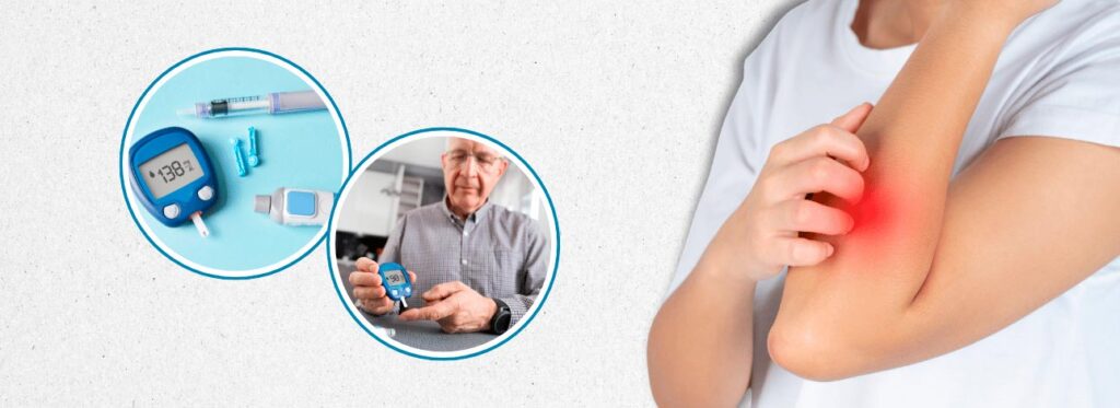 spx-clinica-spx-imagem-sinais-de-diabetes-na-pele