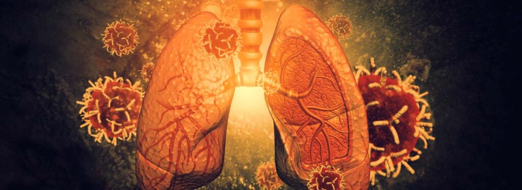 spx-clinica-spx-imagem-virus-pode-ajudar-a-tratar-inflamacoes-pulmonares