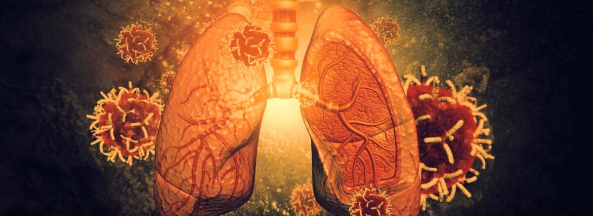 spx-clinica-spx-imagem-virus-pode-ajudar-a-tratar-inflamacoes-pulmonares