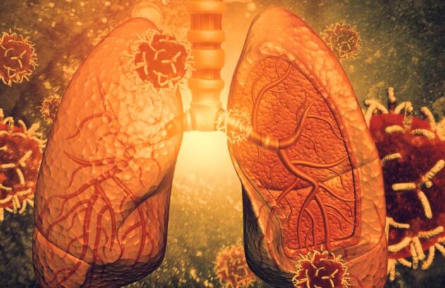 spx-clinica-spx-imagem-virus-pode-ajudar-a-tratar-inflamacoes-pulmonares
