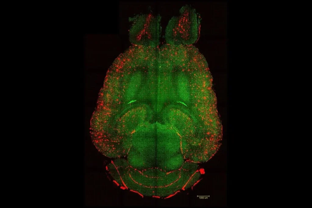 spx-clinica-Cientistas-revertem-Alzheimer-em-camundongos-usando-nanoparticulas-e1759847959276