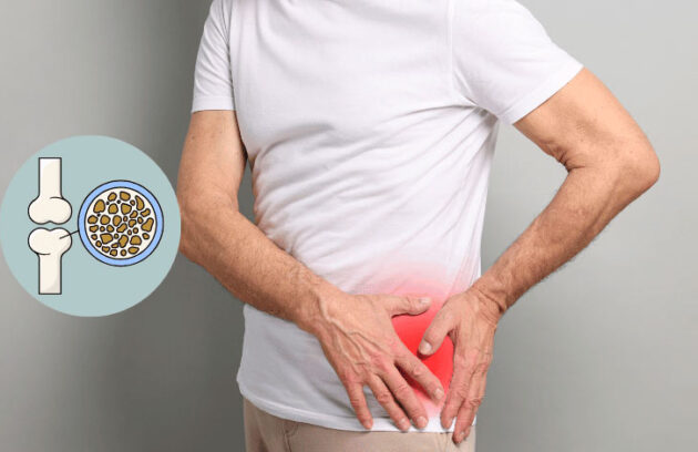spx-clinica-spx-imagem-capa-osteoporose-em-homens