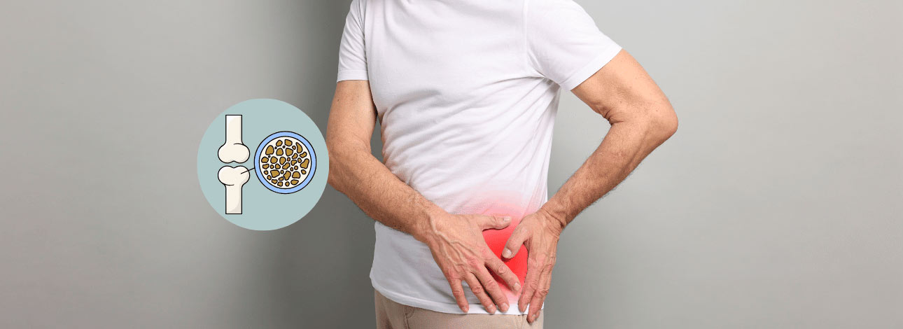 spx-clinica-spx-imagem-capa-osteoporose-em-homens