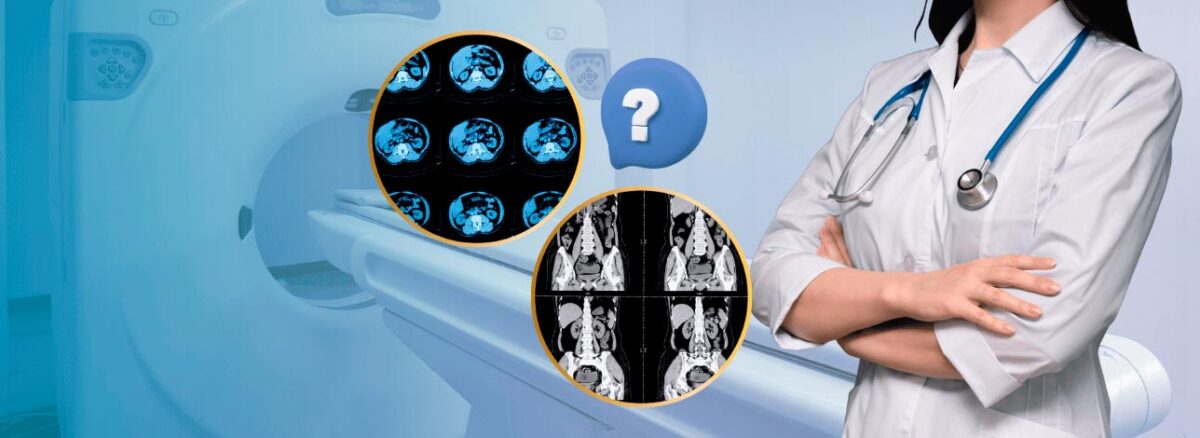 spx-clinica-spx-imagem-mitos-sobre-contraste-em-exames-de-imagem