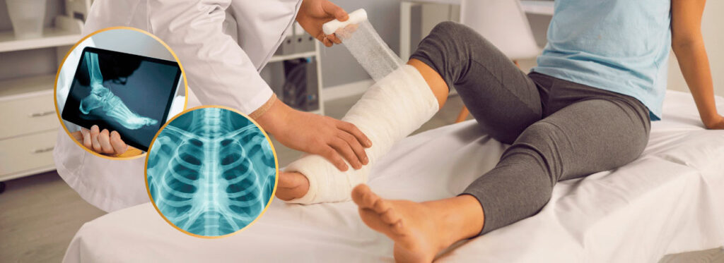 spx-clinica-spx-imagem-raio-x-apos-quedas-e-traumas