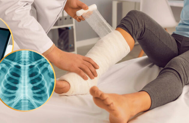 spx-clinica-spx-imagem-raio-x-apos-quedas-e-traumas