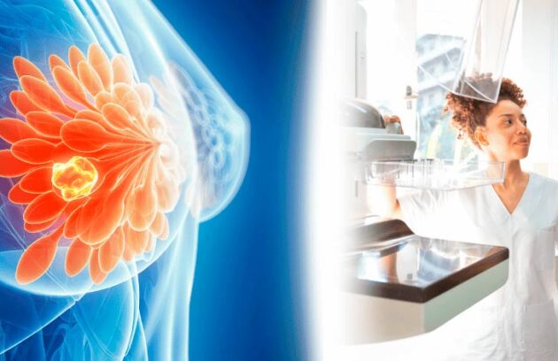 spx-clinica-spx-imagem-resistencia-ao-tratamento-do-cancer-de-mama