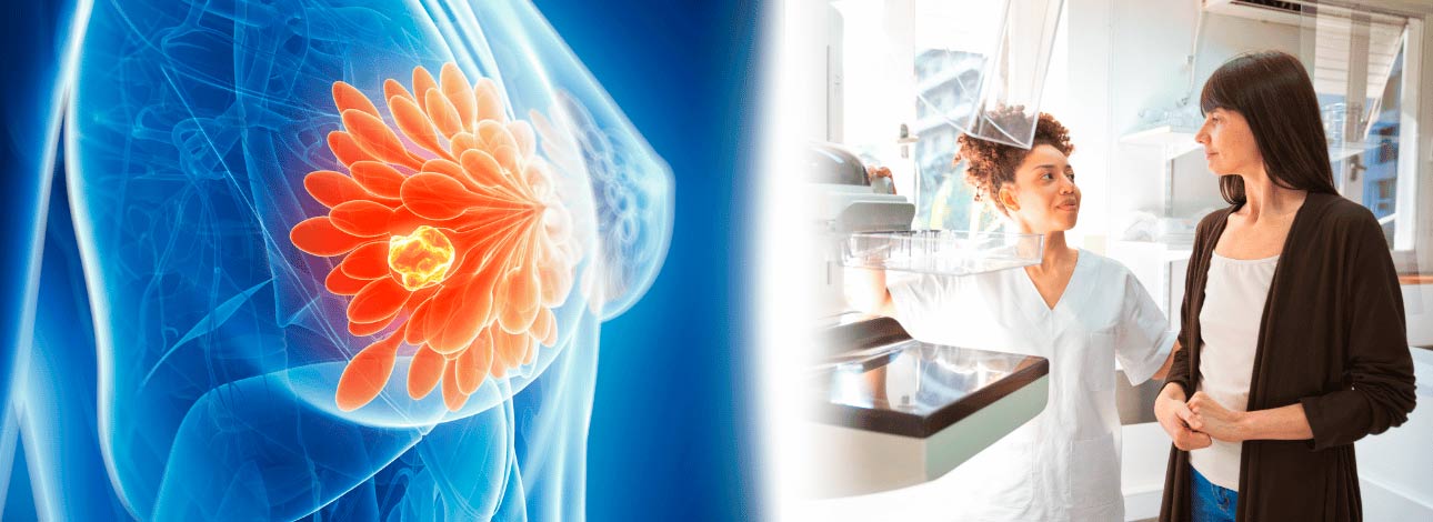 spx-clinica-spx-imagem-resistencia-ao-tratamento-do-cancer-de-mama