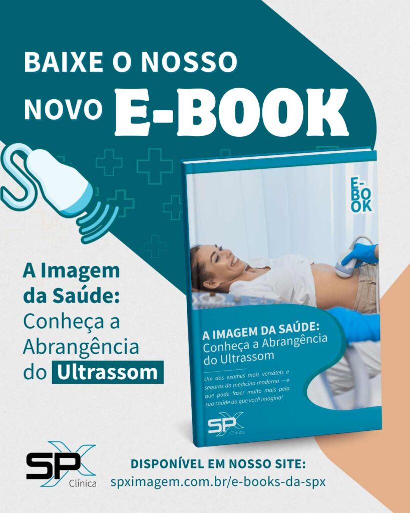 E-book gratuito da SPX Diagnóstico por Imagem sobre o exame de Ultrassom