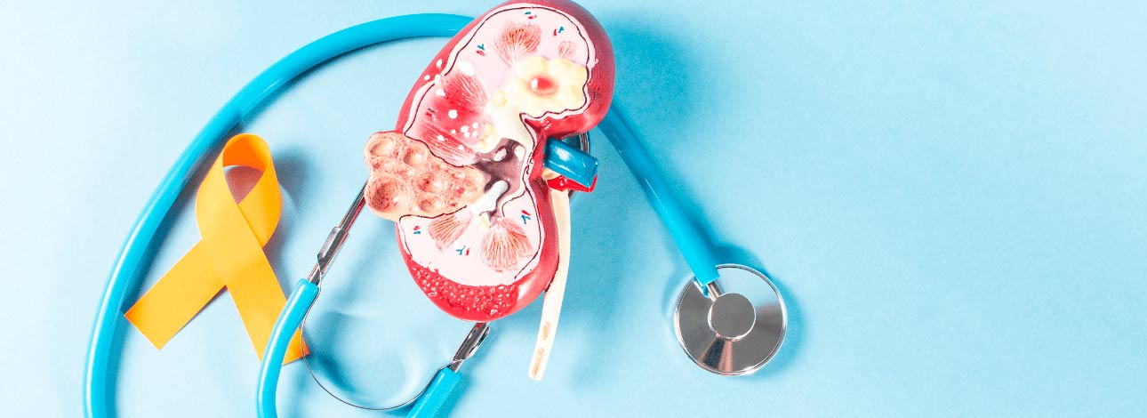 Estetoscópio junto com a imagem de um rim e um laço de fita amarelo para retratar o cuidado com a saúde masculina