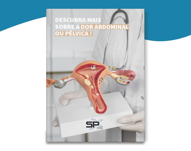 EBOOK - Descubra mais sobre a dor abdominal ou pélvica - Ginecologia