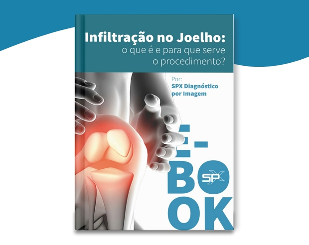EBOOK - Infiltração no Joelho