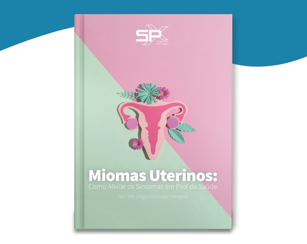 EBOOK - Miomas uterinos - Ginecologia