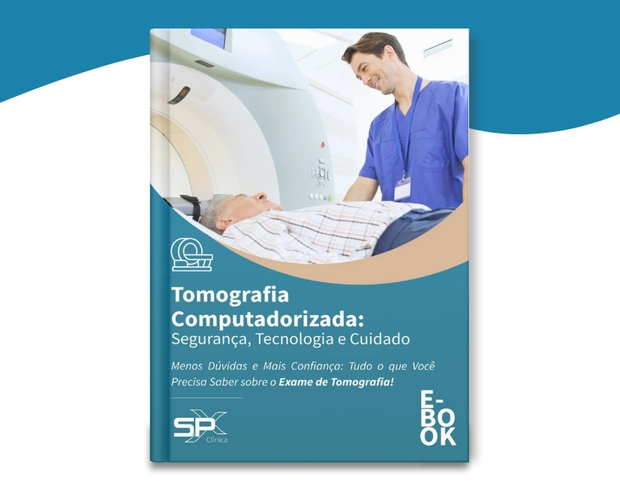 EBOOK - Tomografia Computadorizada - Exame de Tomografia