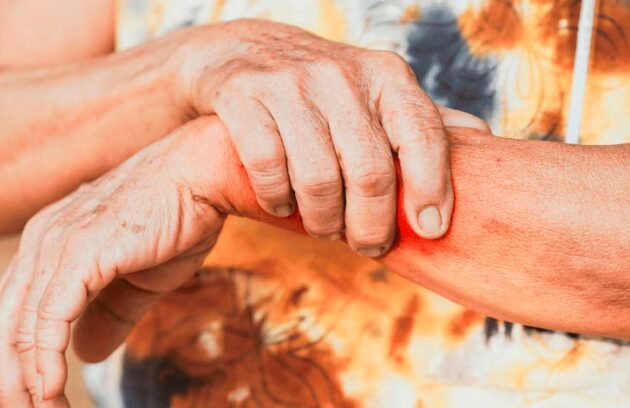 Mulher com dores segurando o braço