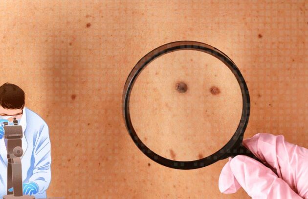 Especialista analisando manchas na pele com uma lupa