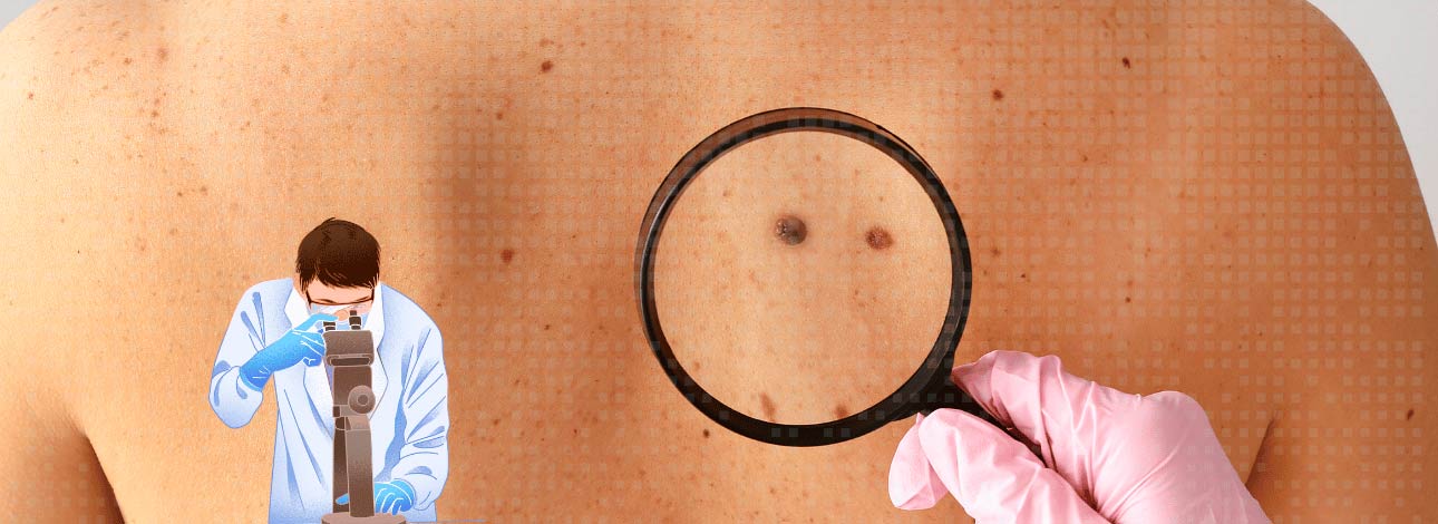 Especialista analisando manchas na pele com uma lupa