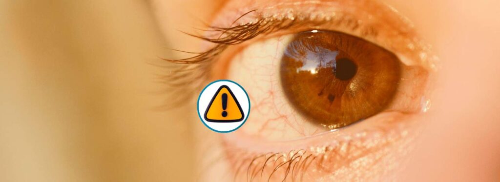 Olho em detalhe com símbolo de atenção