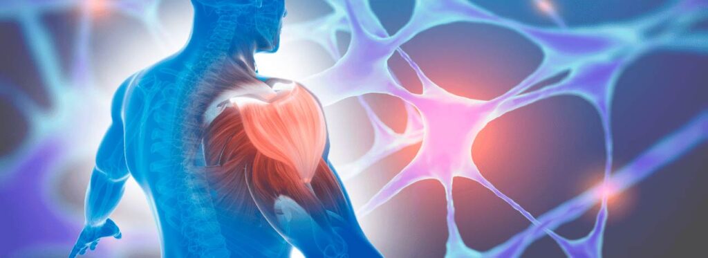 Nervo ao fundo com imagem 3D de um músculo se recuperando de lesão