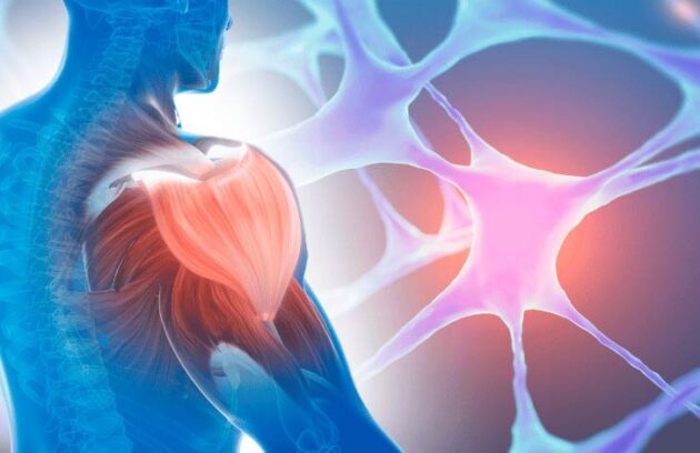 Nervo ao fundo com imagem 3D de um músculo se recuperando de lesão