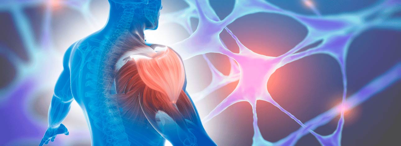 Nervo ao fundo com imagem 3D de um músculo se recuperando de lesão