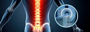 Coluna vertebral na Ressonância Magnética