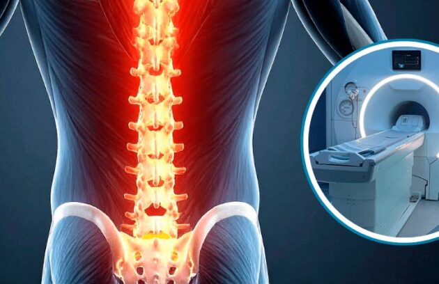 Coluna vertebral na Ressonância Magnética