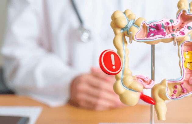 Representação de um intestino com um médico ao fundo