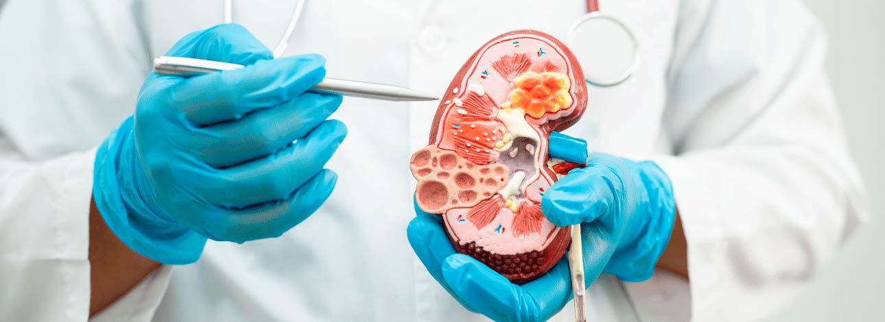 Médico indicando um problema renal