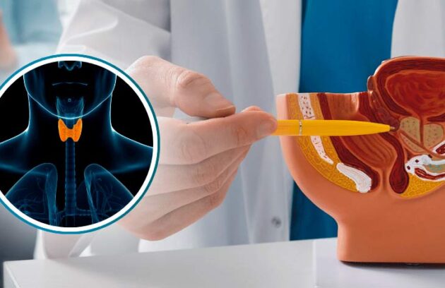 Médico apontando para a próstata