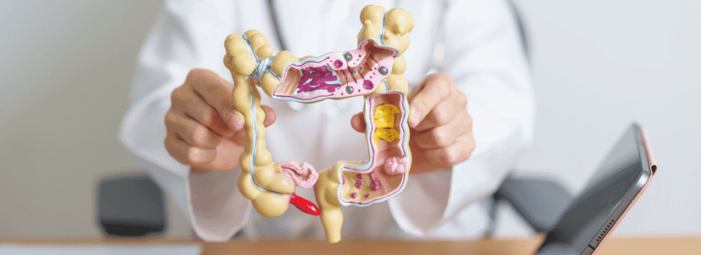 Médico segurando a representação de um intestino