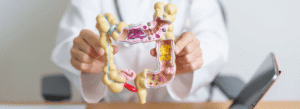 Médico segurando a representação de um intestino