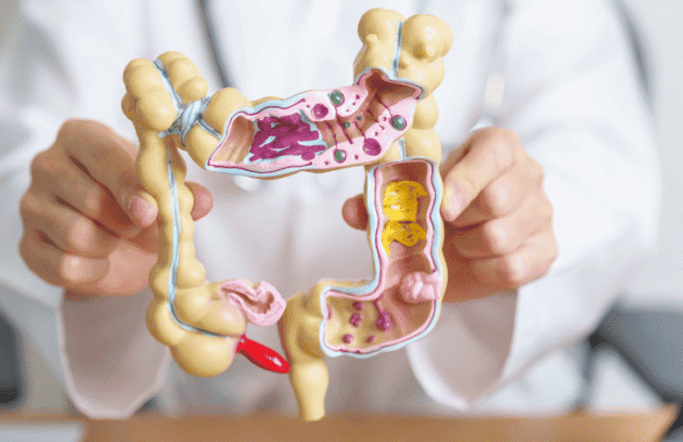 Médico segurando a representação de um intestino