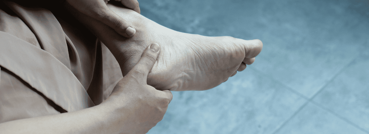 Pessoa com a mão no pé sofrendo com bolhas e calos